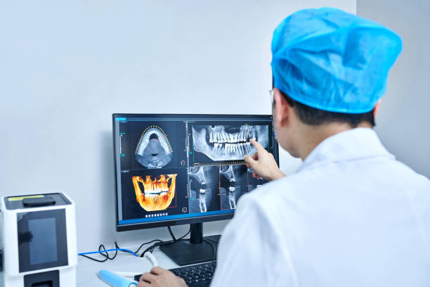 Best Emergency Wisdom Teeth Removal in Graton, CA